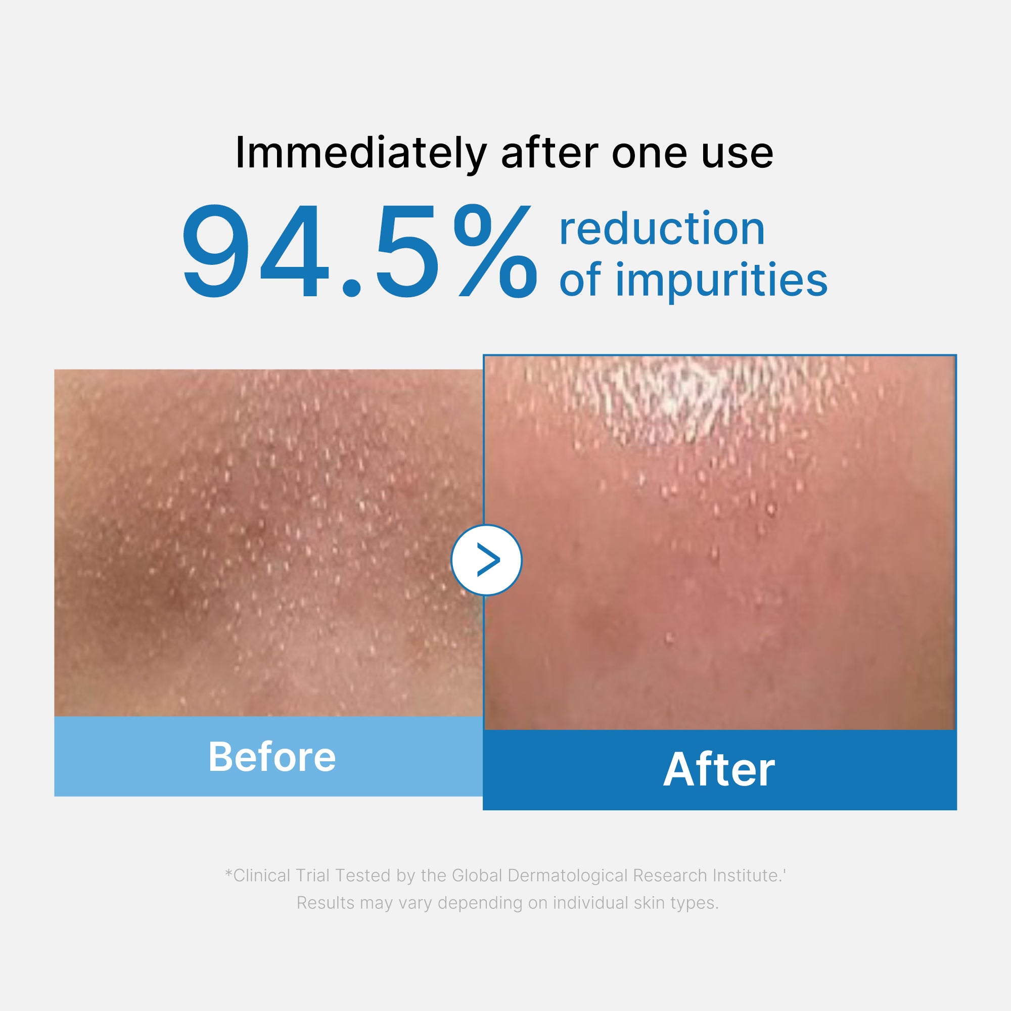 Zero Pore Blackhead Deep Cleansing Oil - Image 2
