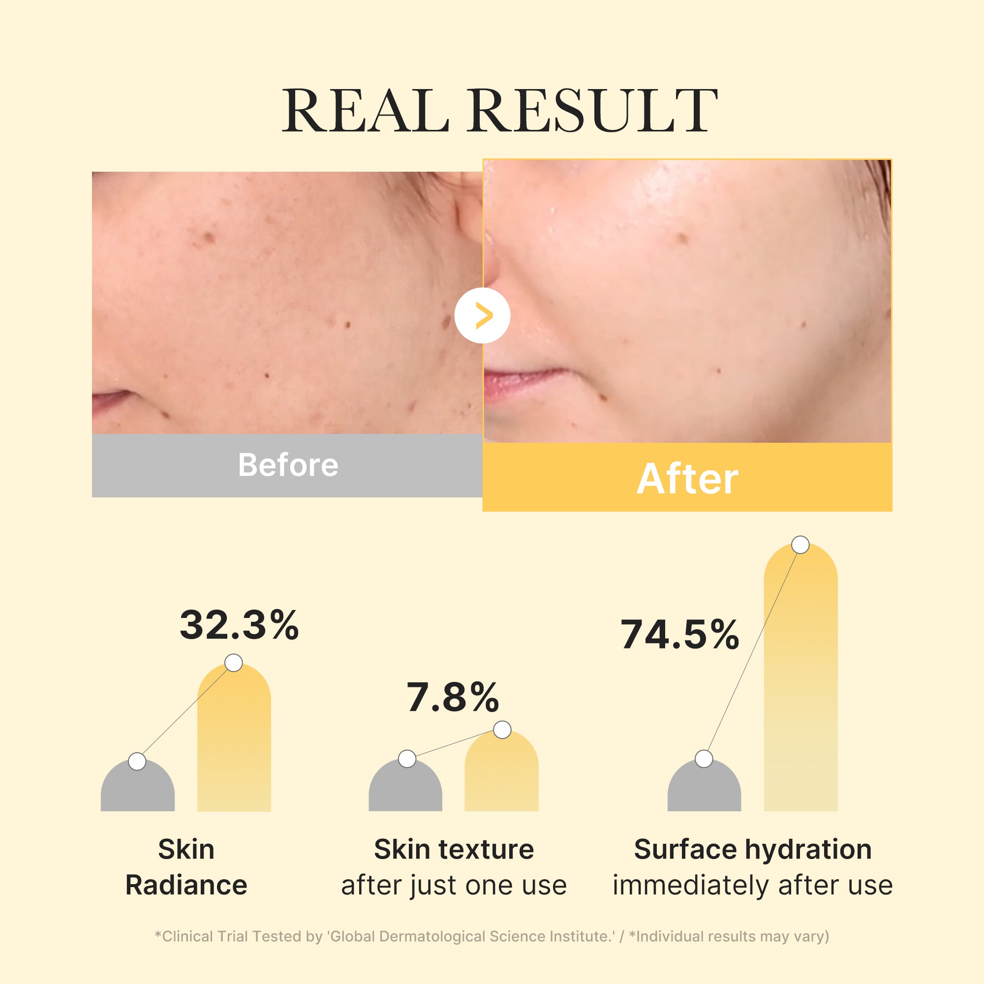 Kojic Acid Turmeric Gold Jelly Gel Mask - Image 3