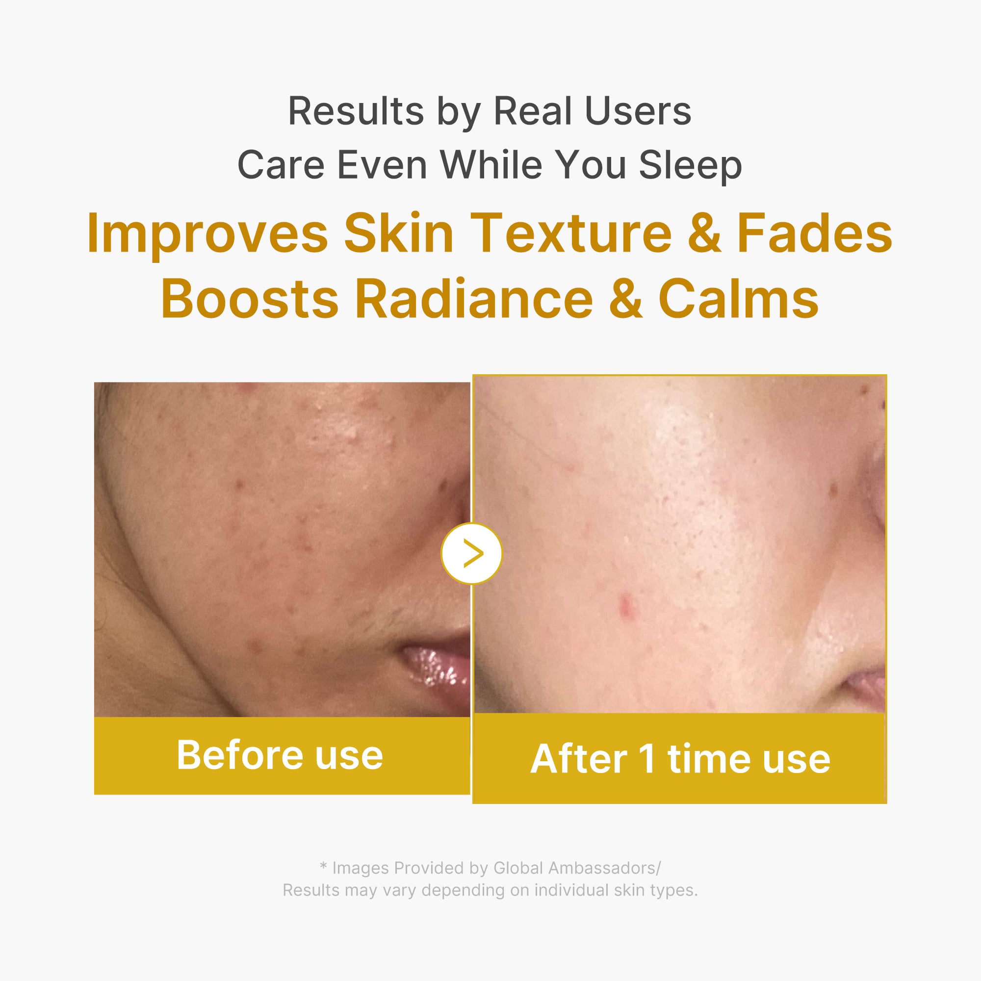 Kojic Acid Turmeric Overnight Wrapping Mask - Image 6