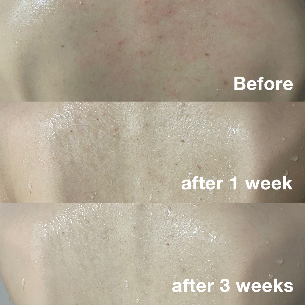 Red Body Wash - Image 9